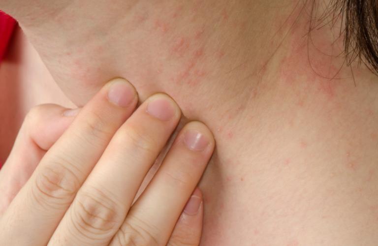 Person touching a red, irritated patch on the neck.